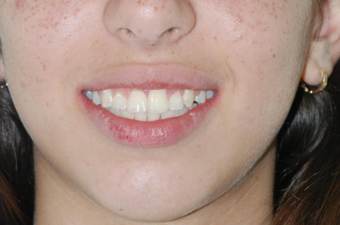 דוגמאות נוספות - לפני ואחרי 3