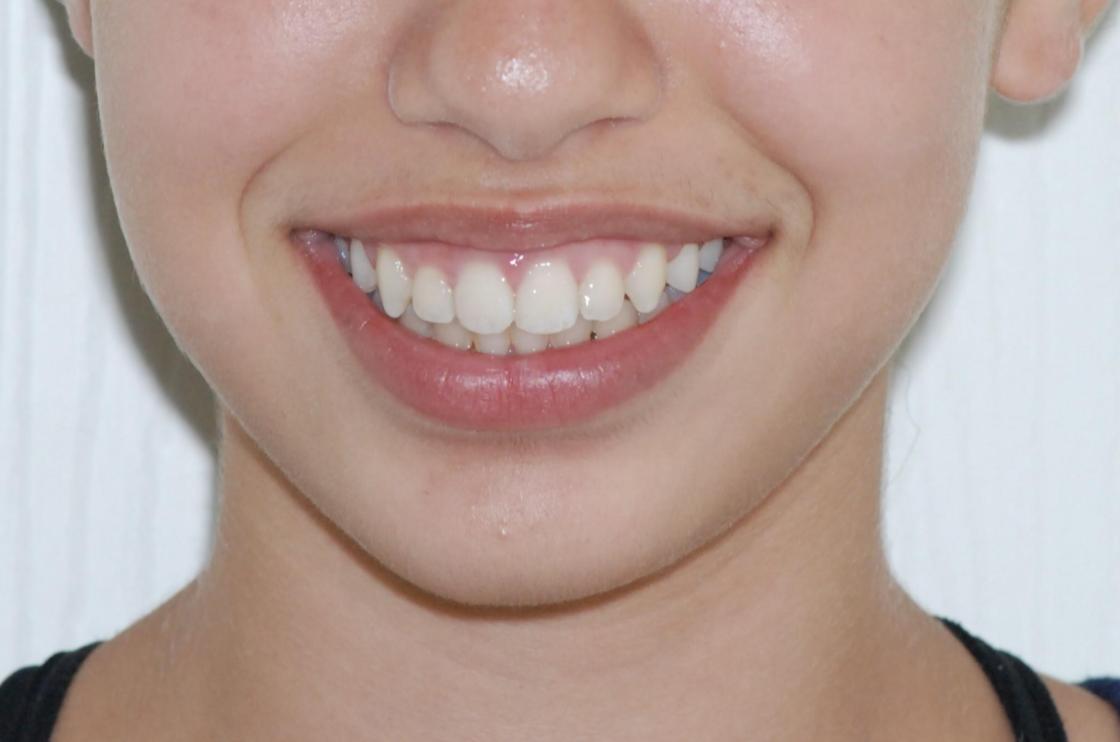 דוגמאות נוספות - לפני ואחרי 5