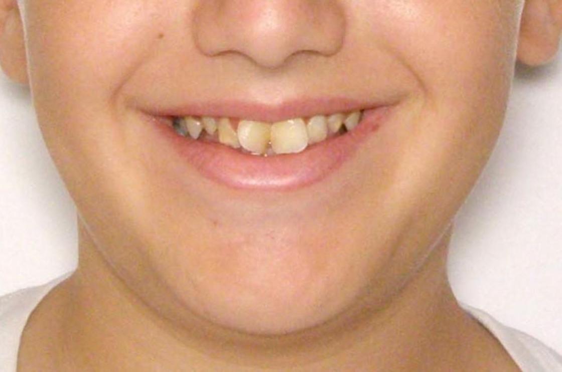 דוגמאות נוספות - לפני ואחרי 8