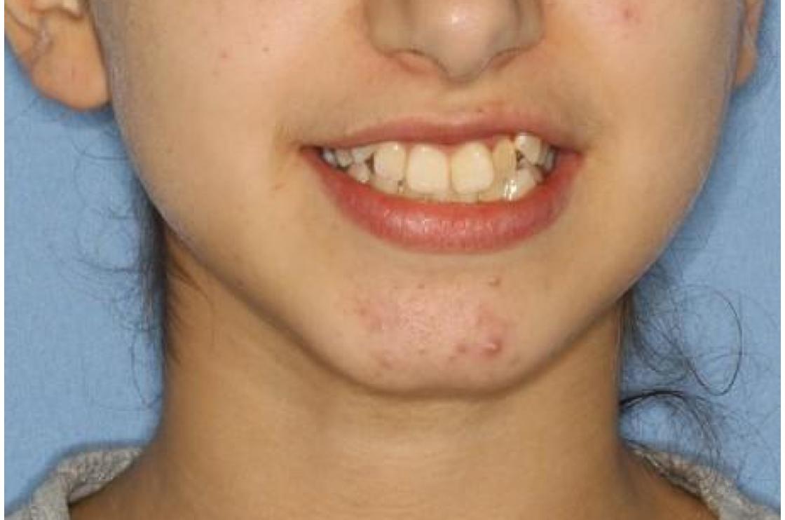 דוגמאות נוספות - לפני ואחרי 10