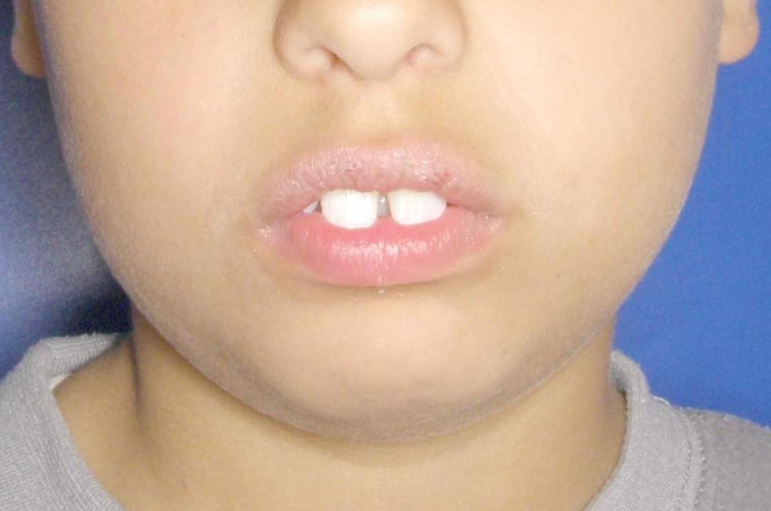 דוגמאות נוספות - לפני ואחרי 12