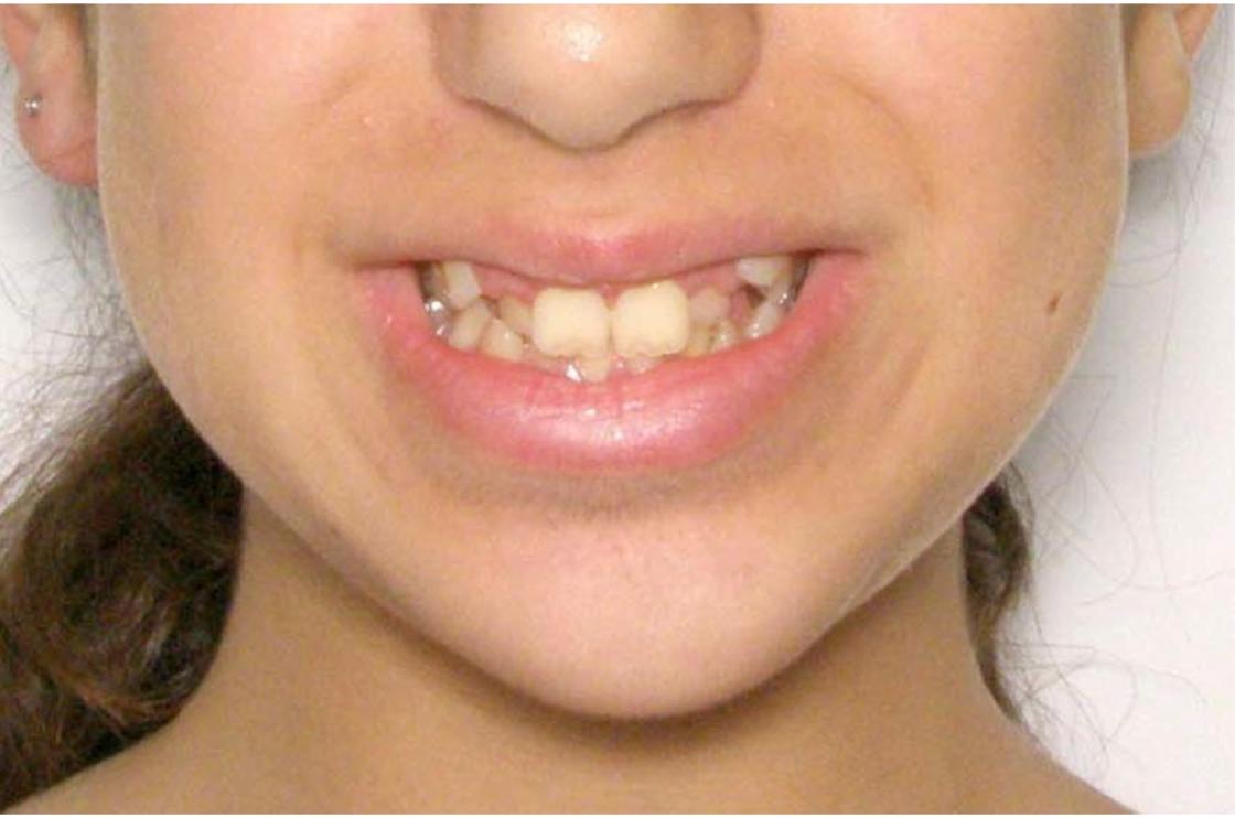 דוגמאות נוספות - לפני ואחרי 14