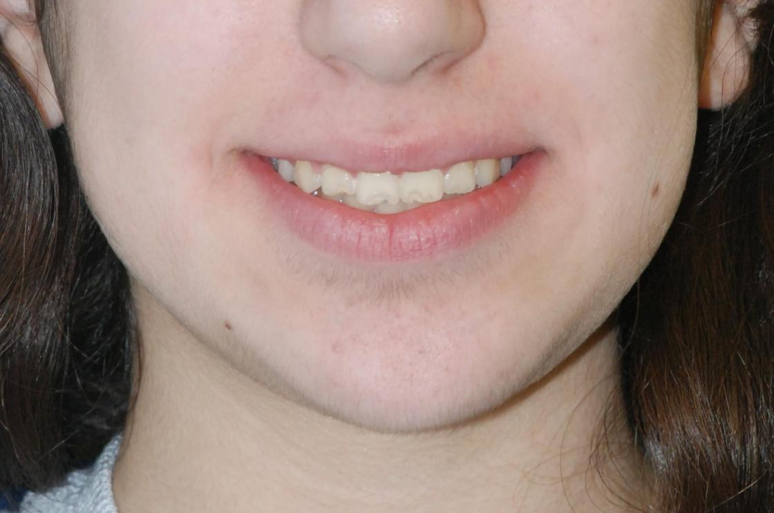 דוגמאות נוספות - לפני ואחרי 13