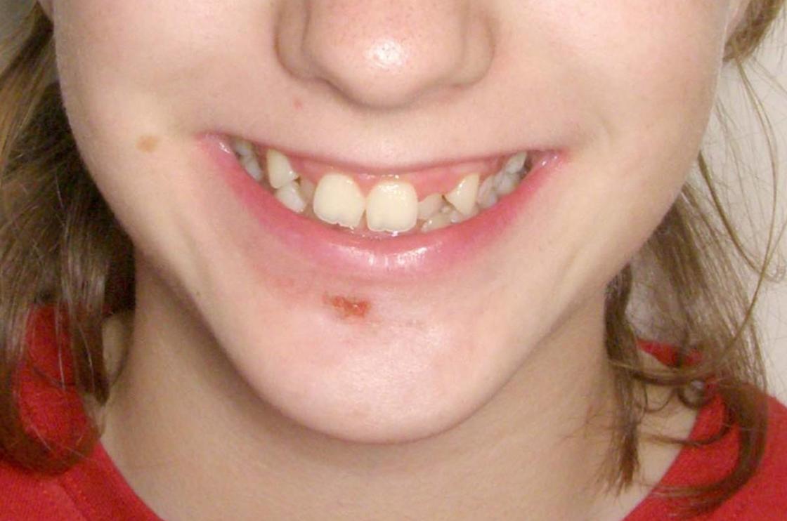 דוגמאות נוספות - לפני ואחרי 16